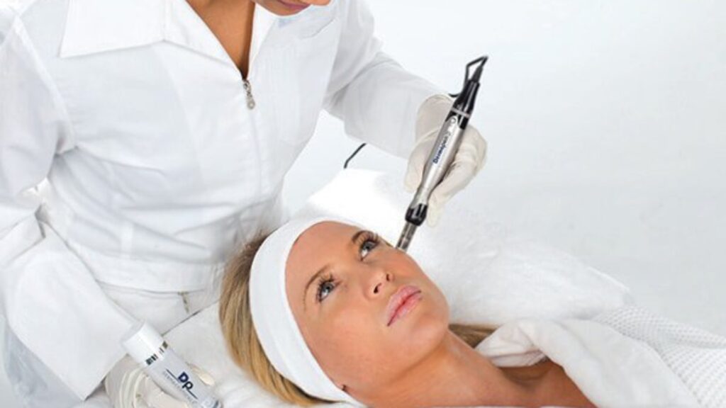 Practitioner using a Dermapen microneedling device on a client's forehead
